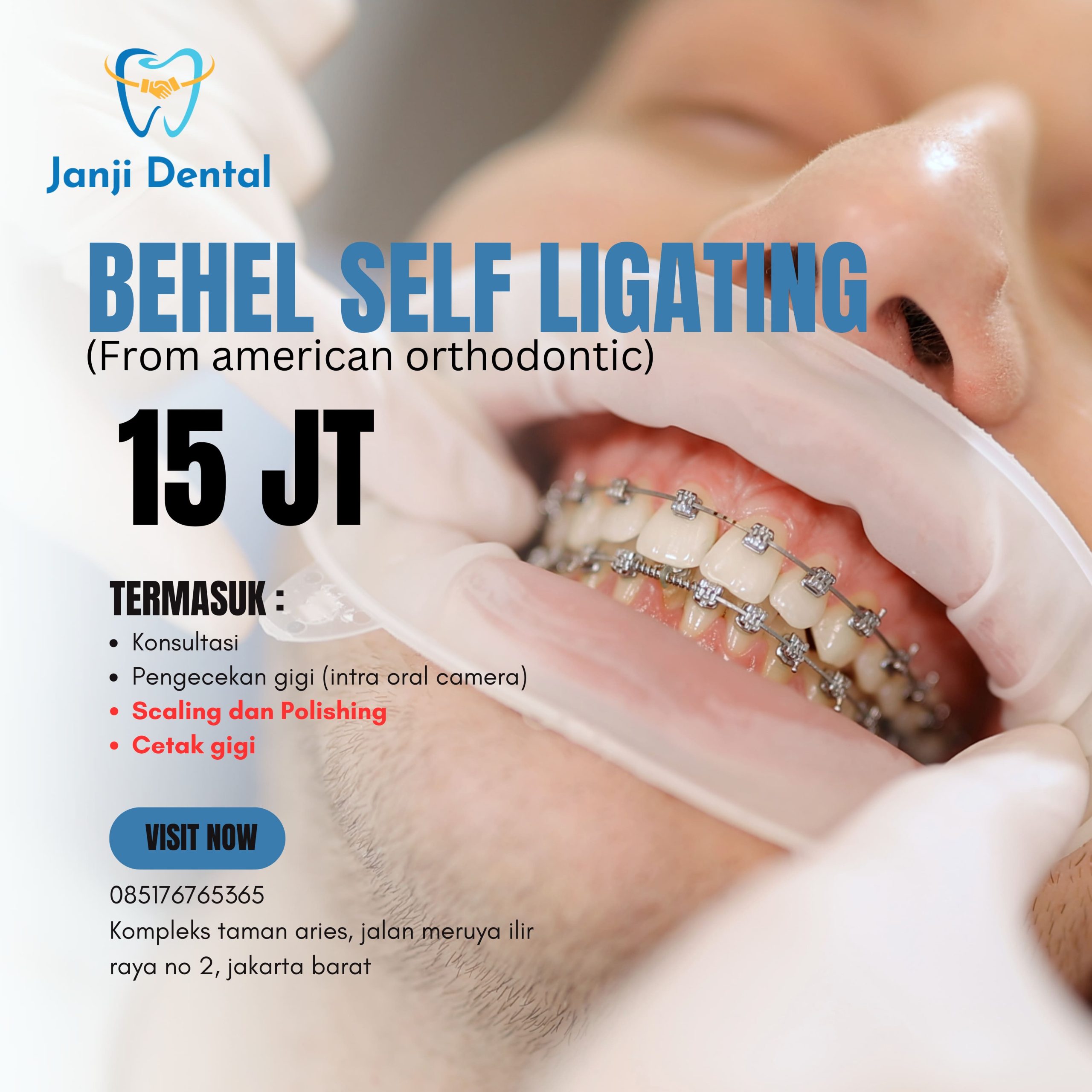 promo behel self-ligating