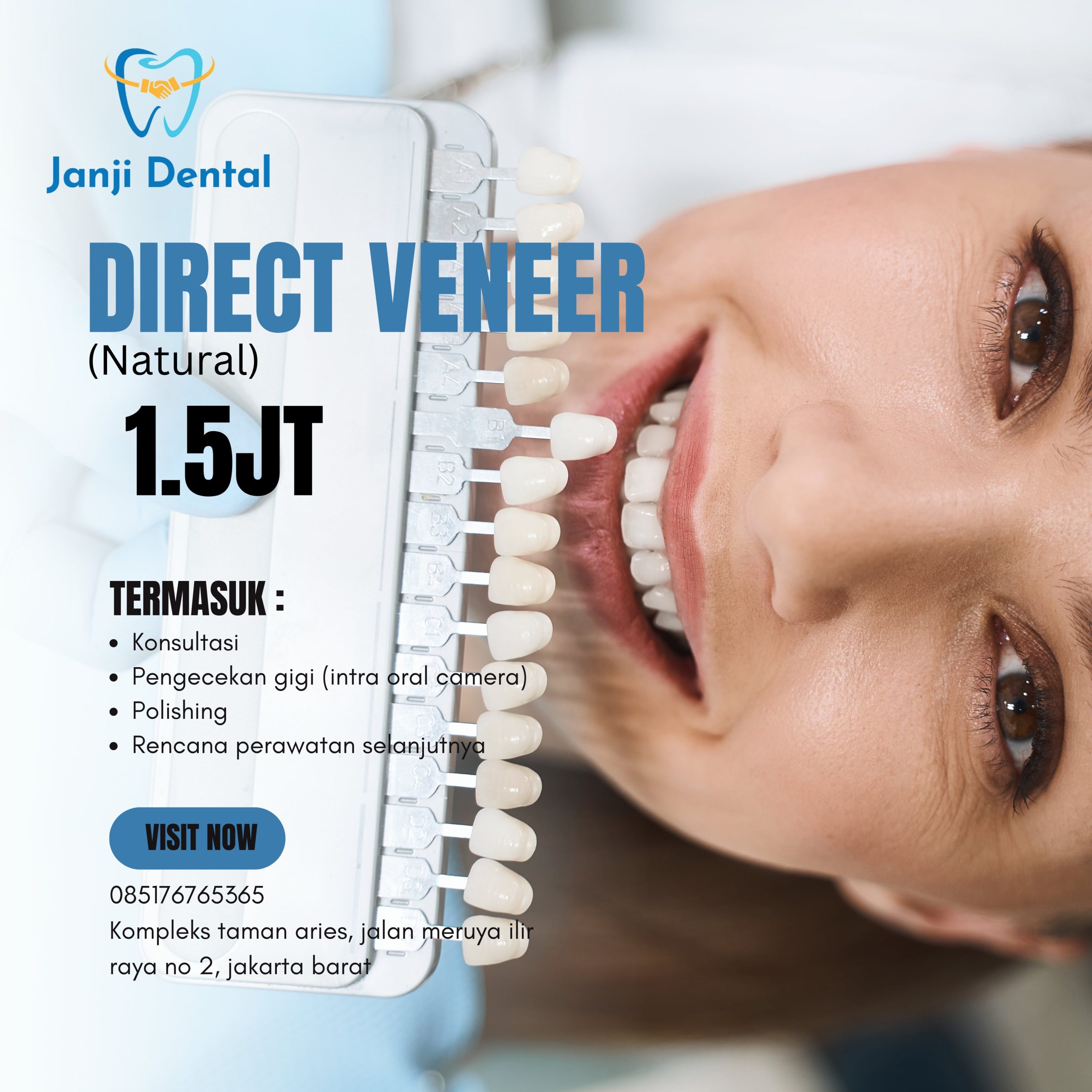 promo direct veneer