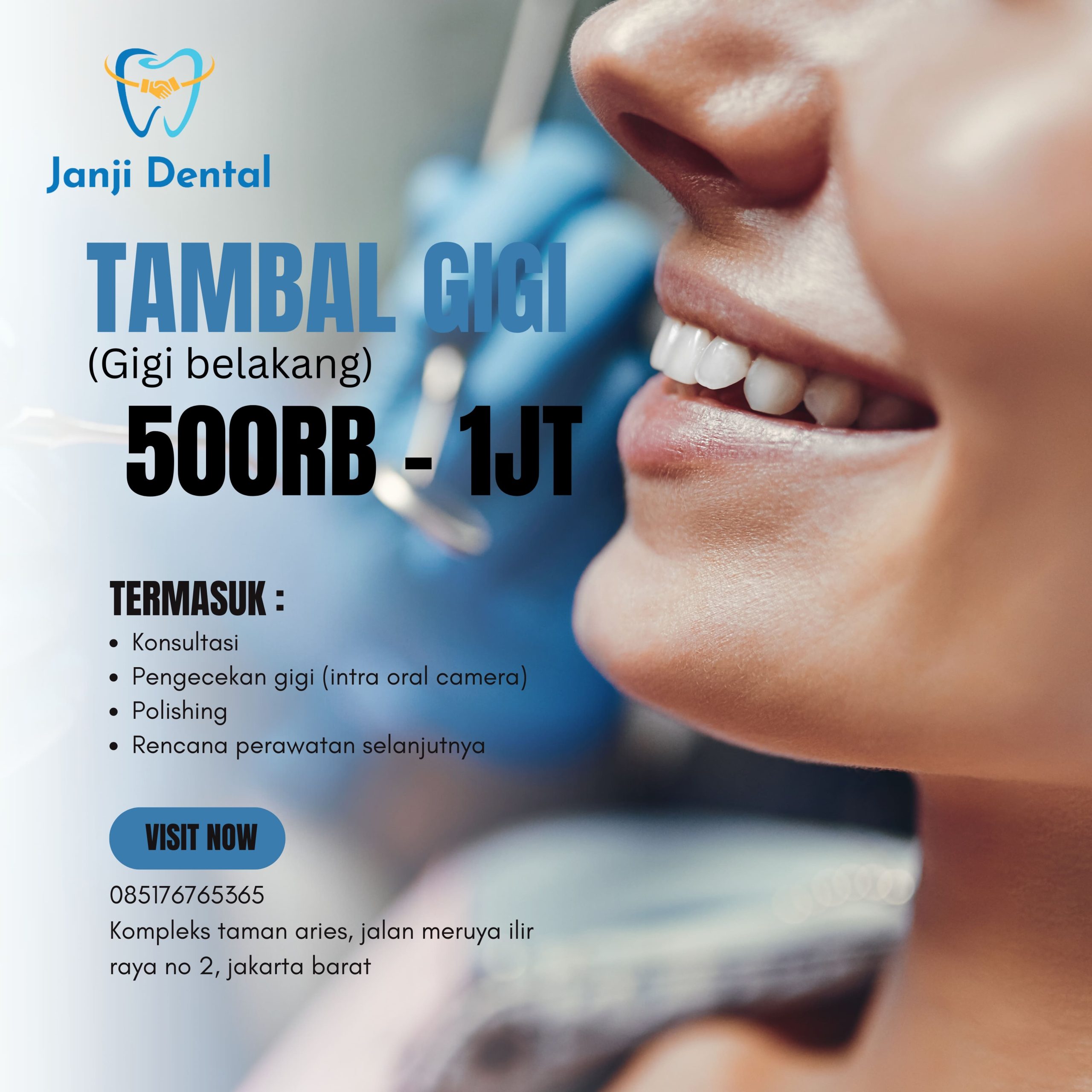 promo tambal gigi belakang