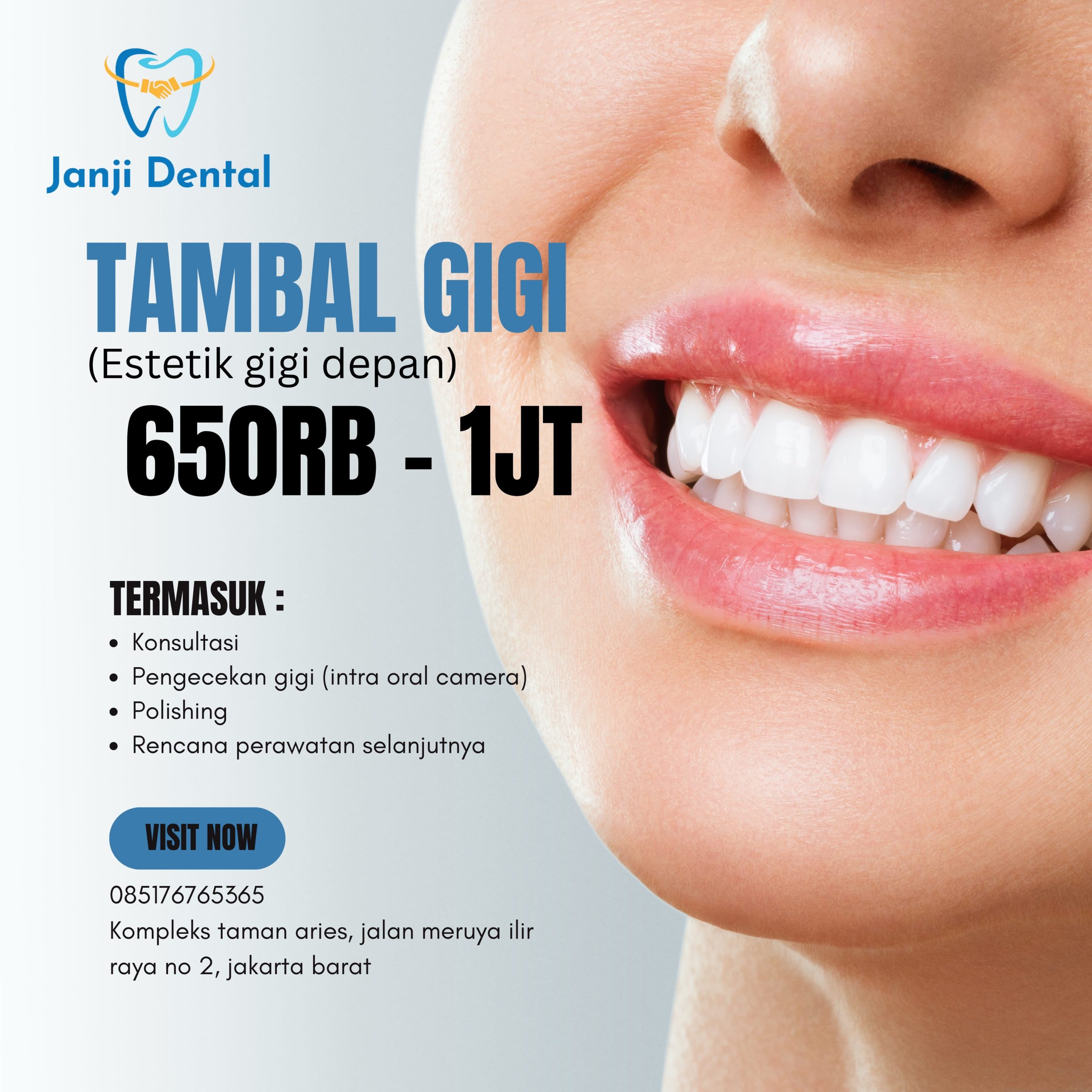 promo tambal gigi depan